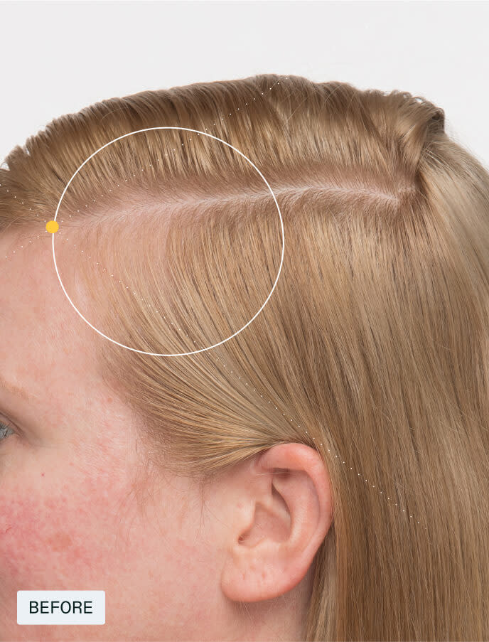 Women’s Balance——For Women 45+experiencing hair thinning