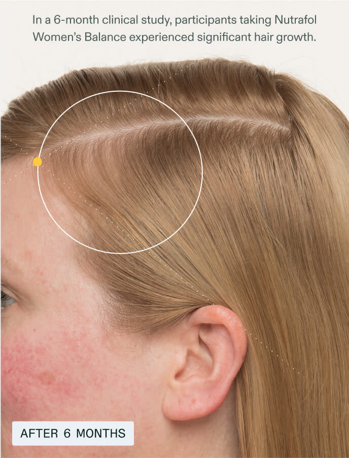 Women’s Balance——For Women 45+experiencing hair thinning