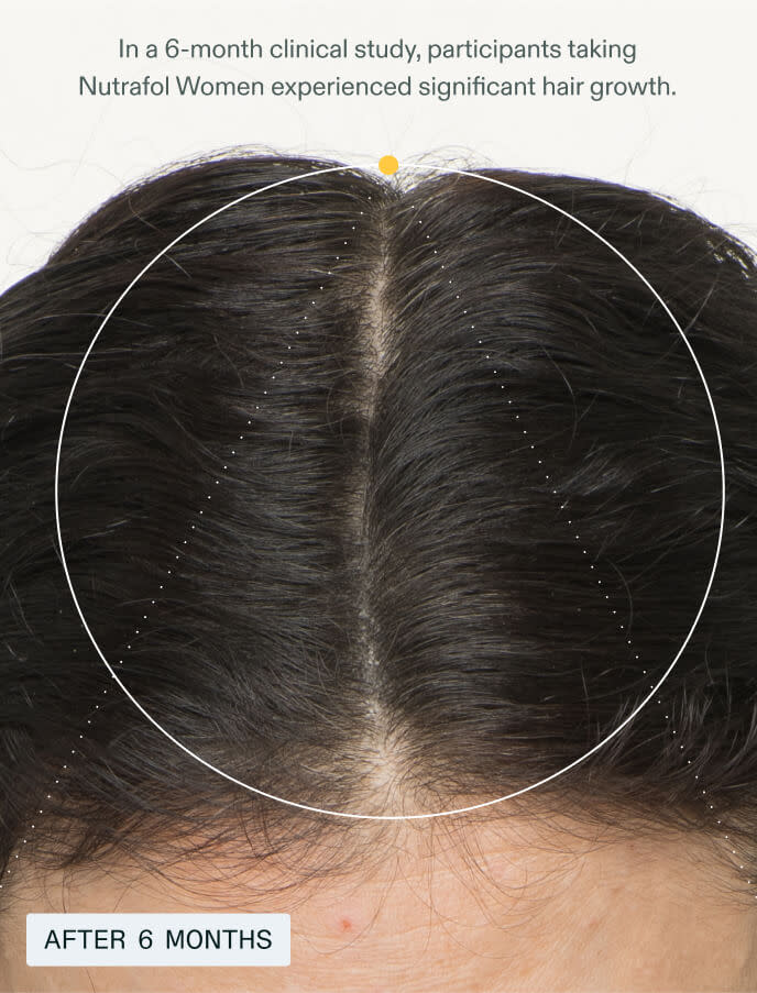 Women——For Women 18-44 experiencing signs of hair thinning
